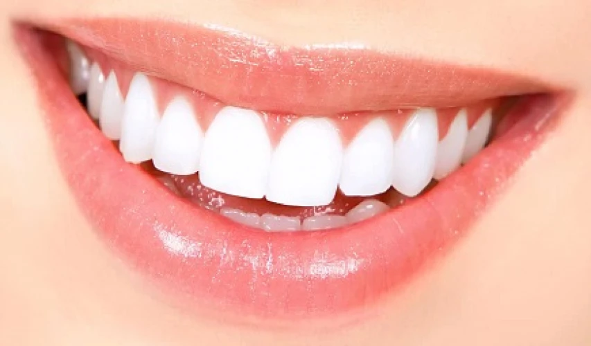 [生意轉讓]簡易經營高利潤牙齒美白相關品牌